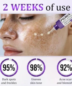 Fivfivgo® PigmentaX ProFade Anti-Hyperpigmentation Cream