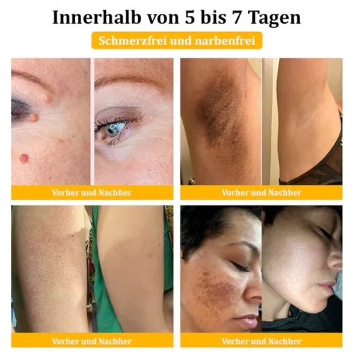 Lovilds™ Bienengift-Hautcreme