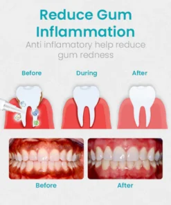 NESLEMY™ Gum Therapy Gel