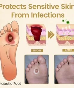 Timilk® Diabetic Foot Healing Spray - Bee Venom Infused