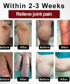 Fivfivgo™ Horse Chestnut Arthritis Massage Cream