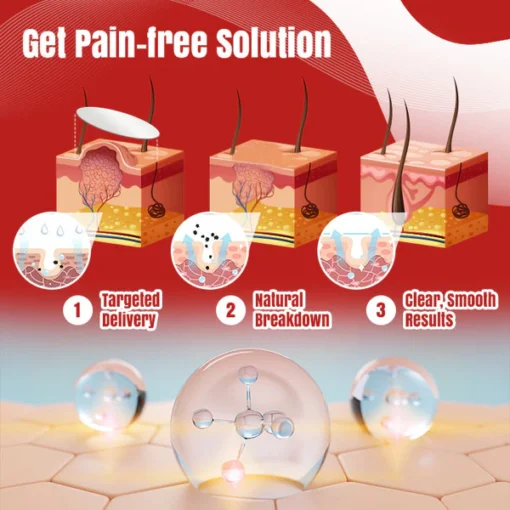 Ceoerty® MicroZaps Hydrocolloid Tag Patch