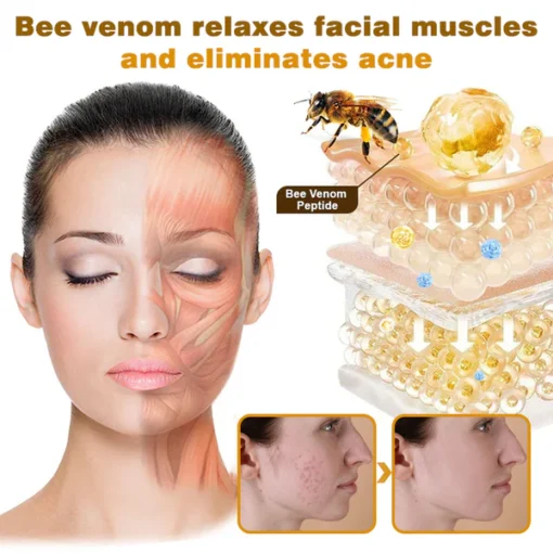 Furzero® Botox Bee Venom Pro MicroDarts Patch