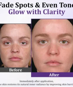 Fivfivgo® PigmentaX ProFade Anti-Hyperpigmentation Cream