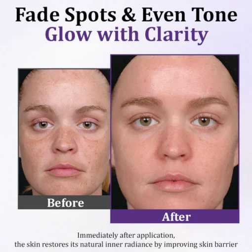 Fivfivgo® PigmentaX ProFade Anti-Hyperpigmentation Cream