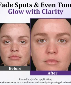 Luhaka® LumiDerma Anti-Hyperpigmentation Cream