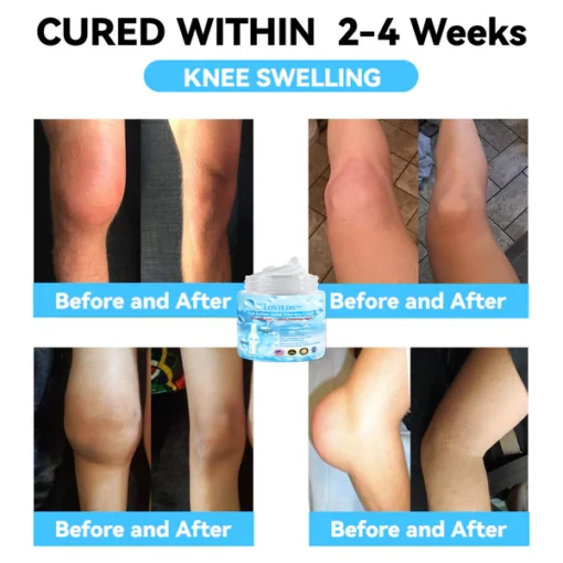 LOVILDS™ 7 Day Rapid Joint & Bone Therapy Cream USA Orthopaedics (AAOS) Approved