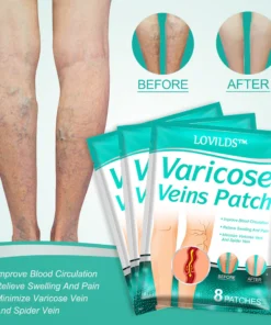 LOVILDS™Leech Varicose Veins Patch