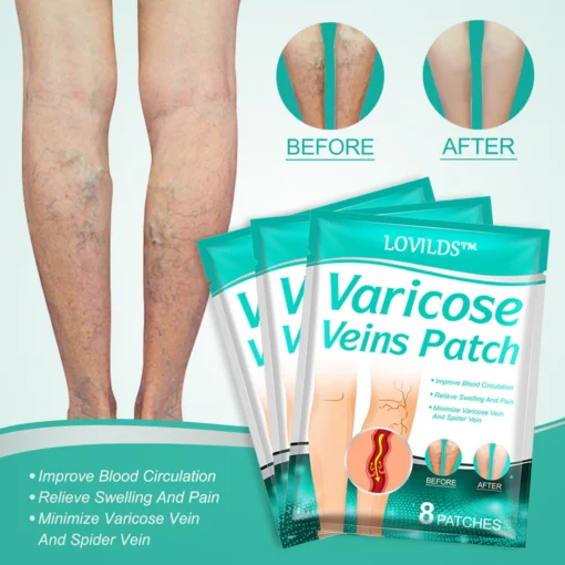 LOVILDS™Leech Varicose Veins Patch