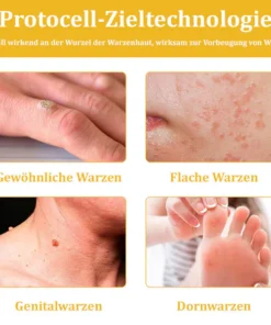 Lovilds™ Bienengift-Hautcreme