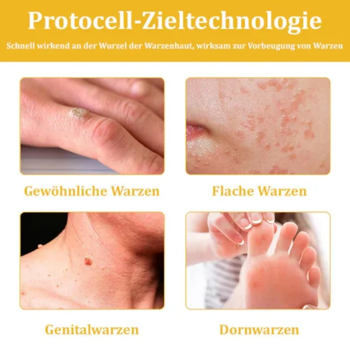 Lovilds™ Bienengift-Hautcreme