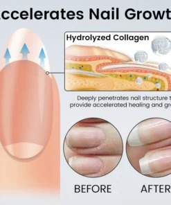 Ceoerty® OnyxoGuard Nail Renew Advanced Repair Serum