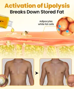 GFOUK™ ThermoFirm Bee Venom Gynecomastia Oil