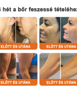 Flysmus™Botox Bee Venom Skin Tightening Essence Stick