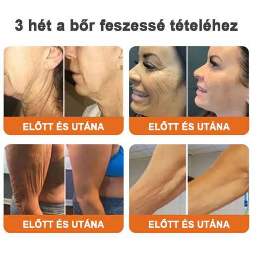 Flysmus™Botox Bee Venom Skin Tightening Essence Stick