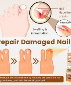 Ceoerty® NailRescue Bee Venom Spray