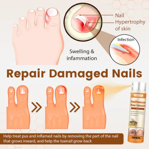 Ceoerty® NailRescue Bee Venom Spray