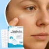 Cvreoz® Nano-Micro Needle Skin Tags Removal Patches