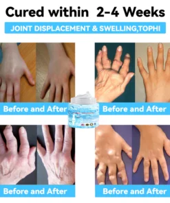 LOVILDS™ 7 Day Rapid Joint & Bone Therapy Cream USA Orthopaedics (AAOS) Approved