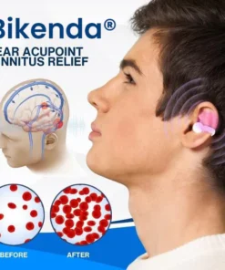 Hypethetic Pharmacy| Bikenda® Ear Acupoint Tinnitus Relief