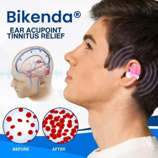 Hypethetic Pharmacy| Bikenda® Ear Acupoint Tinnitus Relief
