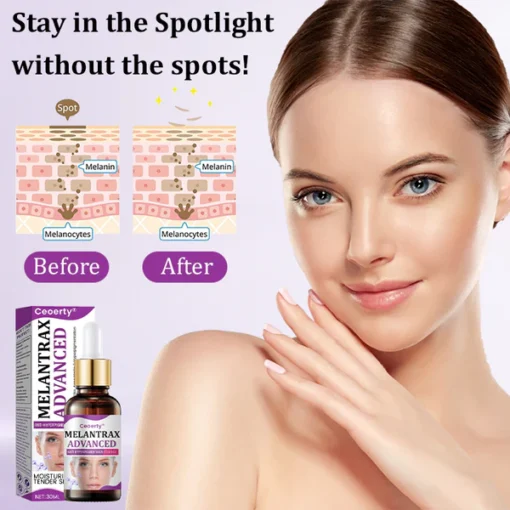 Ceoerty® MelantraX Advanced Anti-Hyperpigmentation Essence