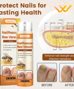 Ceoerty® NailRescue Bee Venom Spray