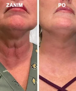 Fubsta™ Anti-Aging Firming Serum