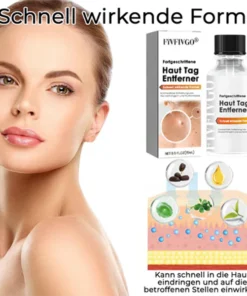 Fivfivgo® Advanced Skin Tag Remover - Fast Acting Formula