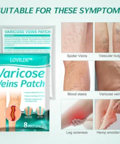 LOVILDS™Leech Varicose Veins Patch