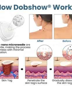 Dobshow® Pro TagsGone Multi-Pattern Patches