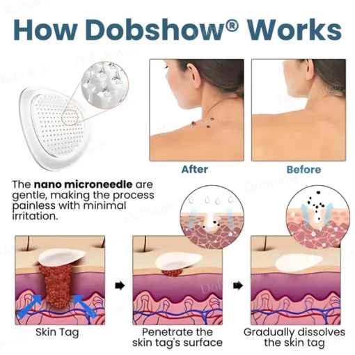 Dobshow® Pro TagsGone Multi-Pattern Patches