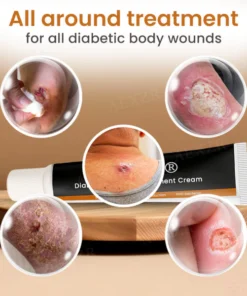 Cvreoz® Diabetic Wounds - ✅ 𝕤𝕒𝕧𝕖 𝕦𝕡 𝕥𝕠 𝟟𝟘% - Treatment Cream