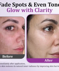 Ceoerty® MelantraX Advanced Anti-Hyperpigmentation Essence