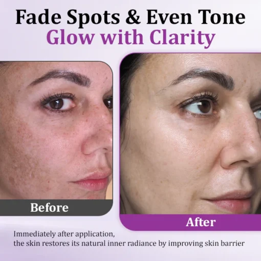 Ceoerty® MelantraX Advanced Anti-Hyperpigmentation Essence