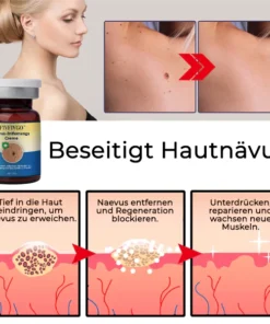Fivfivgo® Nevus Removal Cream
