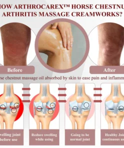 Fivfivgo™ Horse Chestnut Arthritis Massage Cream