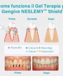 NESLEMY™ Gum Therapy Gel