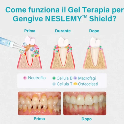 NESLEMY™ Gum Therapy Gel