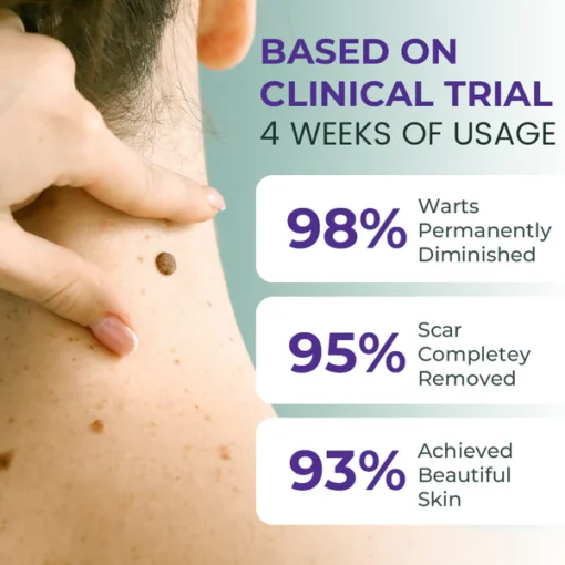 Oveallgo® Clarivine Dissolver Mole & Dark Spot Removal Bio-Gel