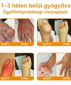 Lidocaine Pain Relief Roll-On Gel