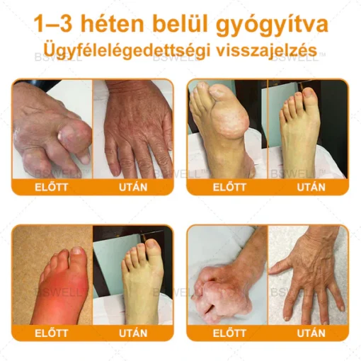 Lidocaine Pain Relief Roll-On Gel