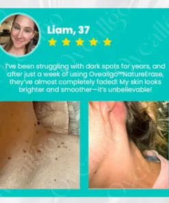 Oveallgo™ EXTRA NatureErase Instant Mole & Spot Cream