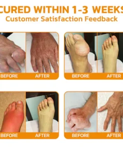 LOVILDS™ Bee poison Pain-Relief Bone Healing Cream