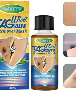 Herbal Acne Treatment Serum