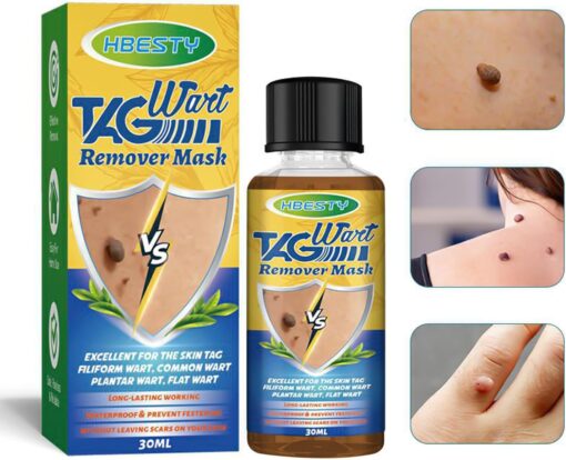 Herbal Acne Treatment Serum