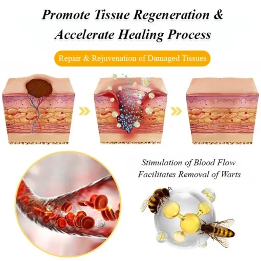 BOOMOON Bee Venom Wart Treatment Spray
