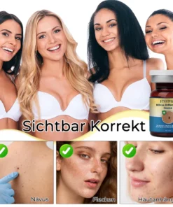 Fivfivgo® Nevus Removal Cream