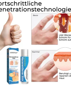 Fivfivgo® Wart Remover Stick