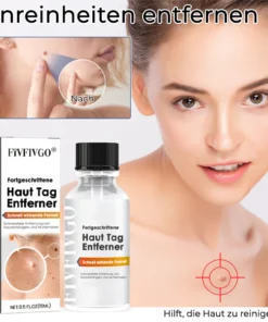 Fivfivgo® Advanced Skin Tag Remover - Fast Acting Formula